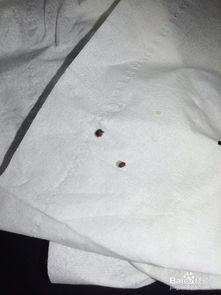 治跖疣视频,治跖疣视频全解析